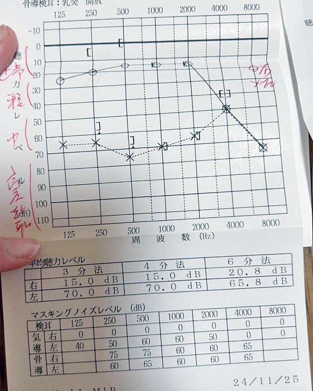 聴力検査 11月25日