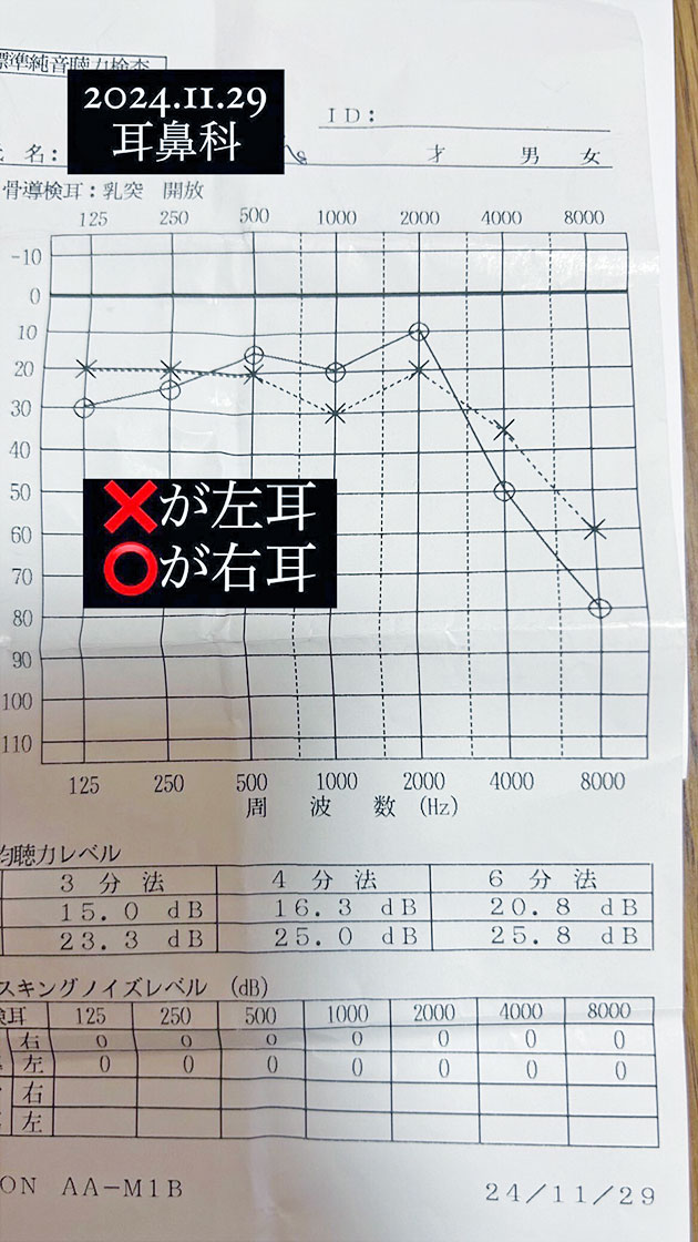 聴力検査 11月29日