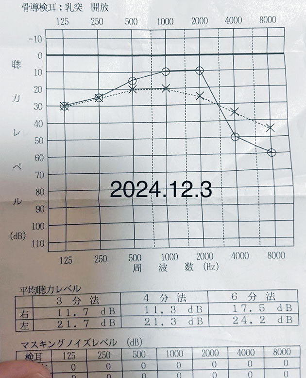 聴力検査 12月3日